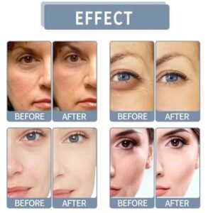 Whitening Niacinamide Serum